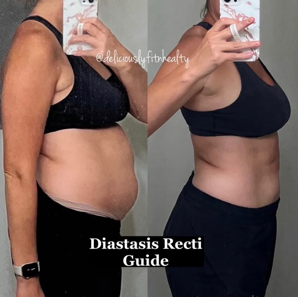 A member's side profile before and after the DR Core Guide