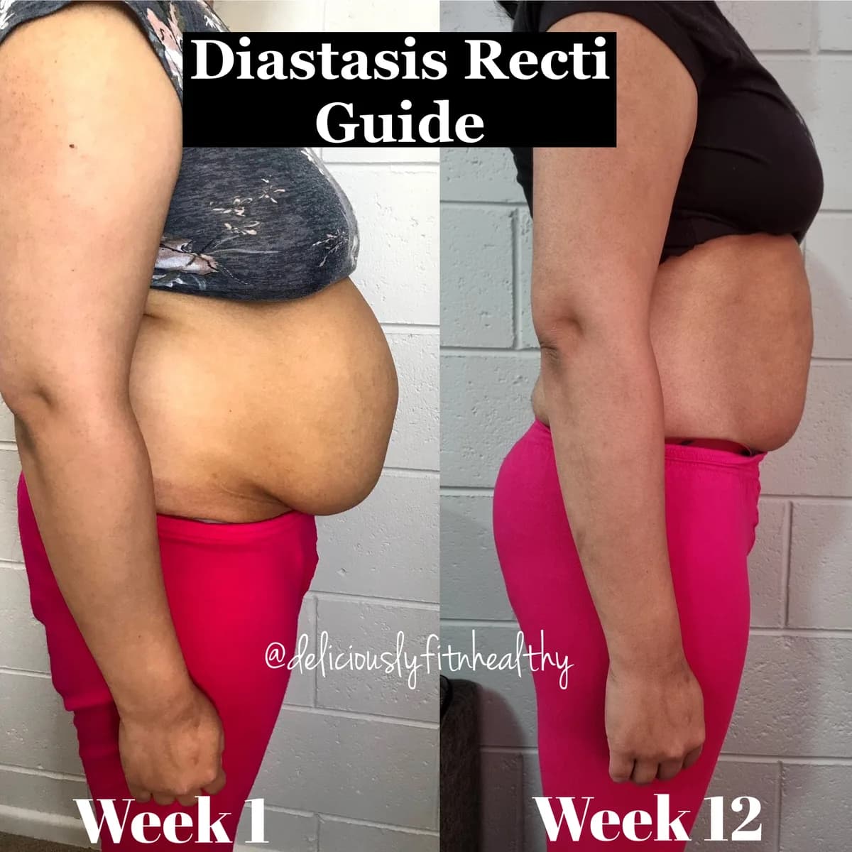 Surbhi S's side profile at week 1 and week 12 of the DR Core Guide