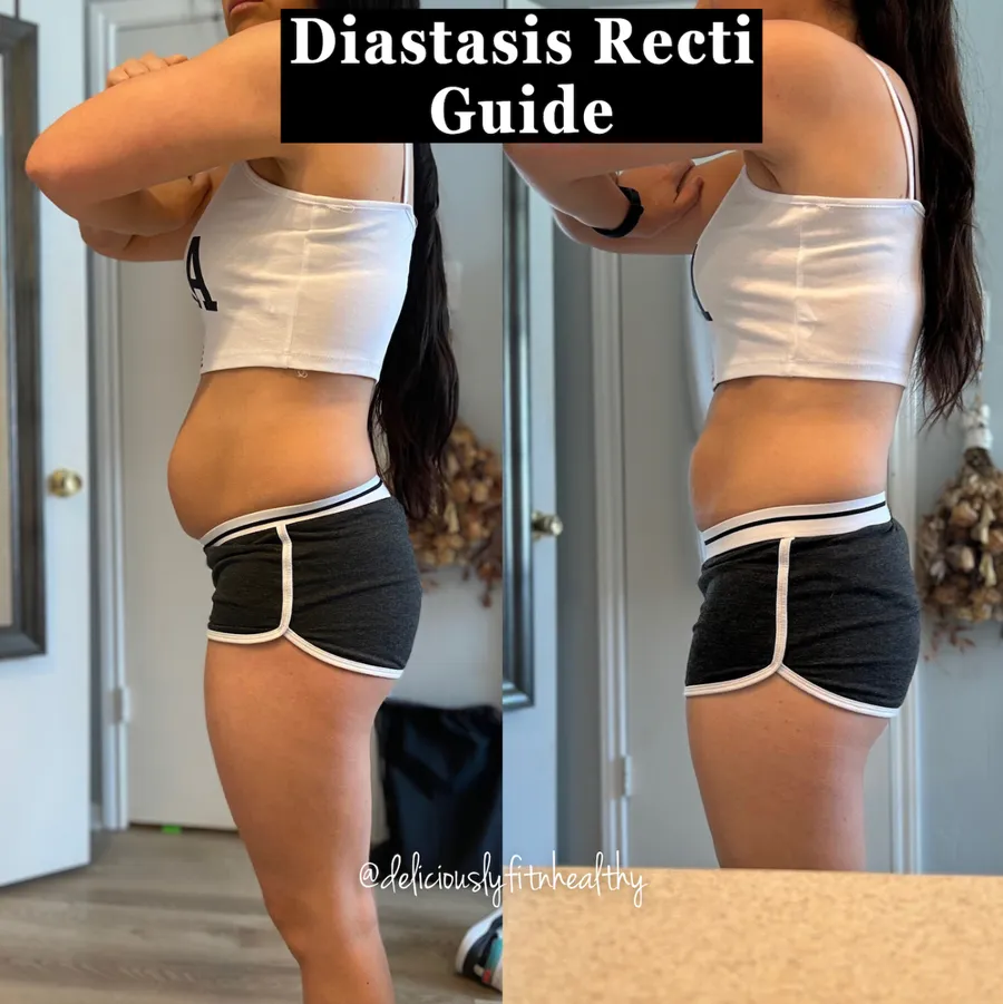Jessica's side-profile before and after the DR Core Guide
