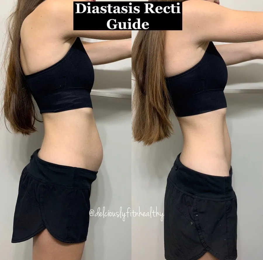 Susannah's side-profile before and after the DR Core Guide